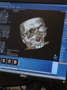 Stu_Accident_Pics_2014 025